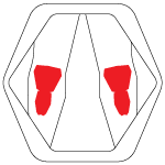 Knee protector